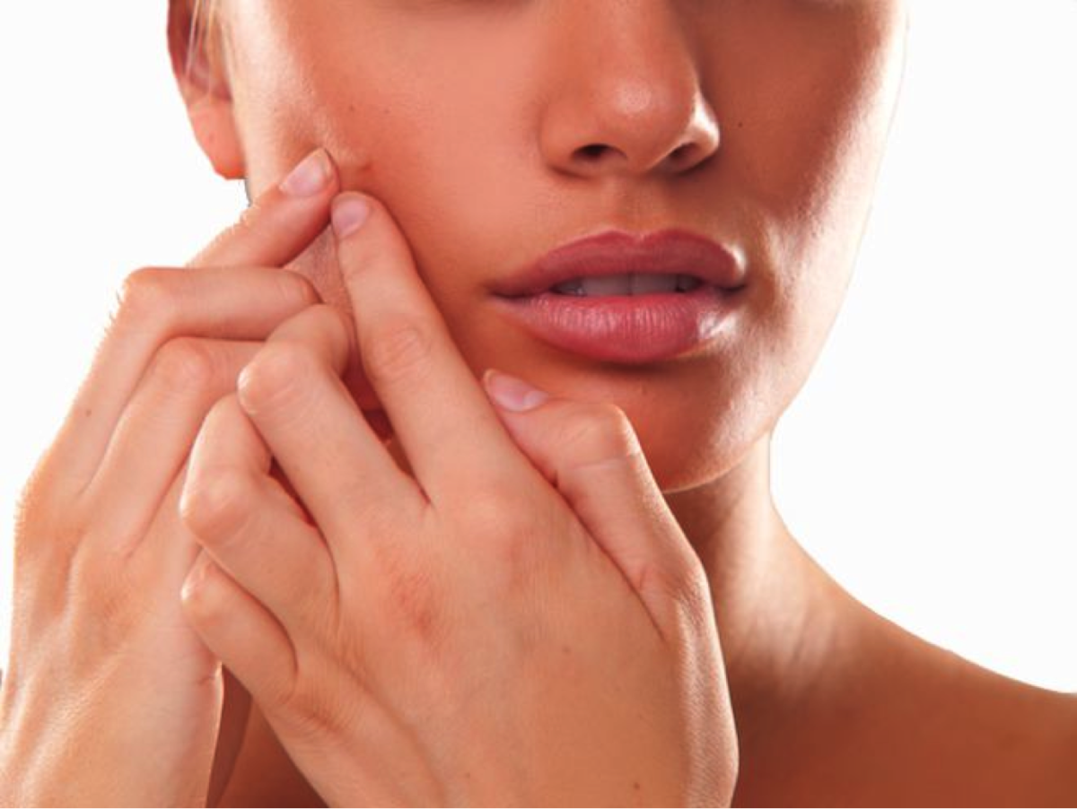 pimple spots