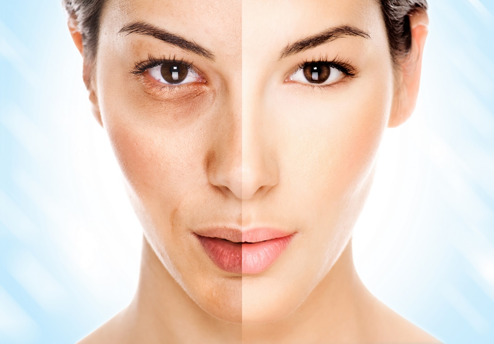 Woman with uneven skin tone on one side and clear skin on the other