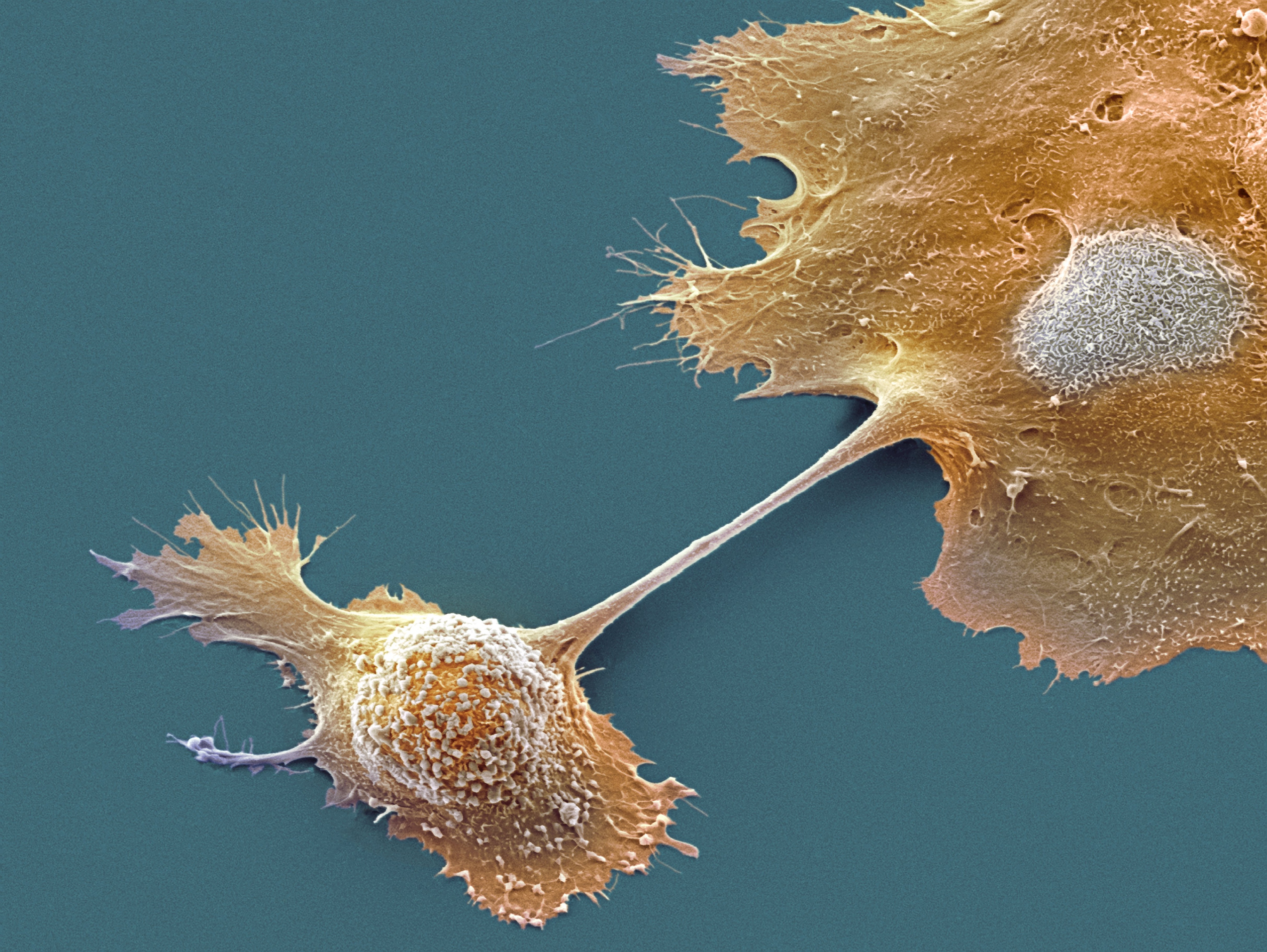 Cancer cells