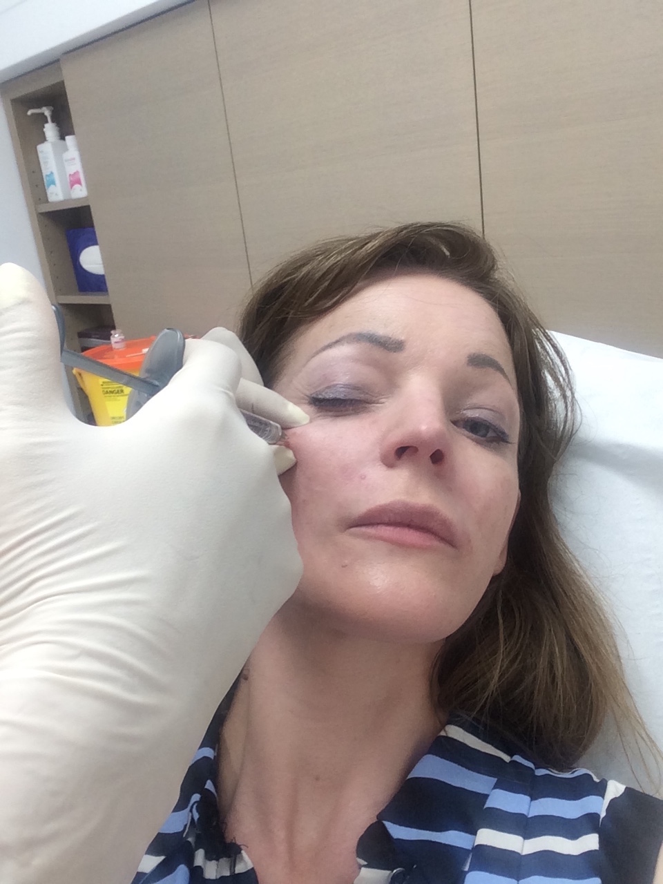 3d facial