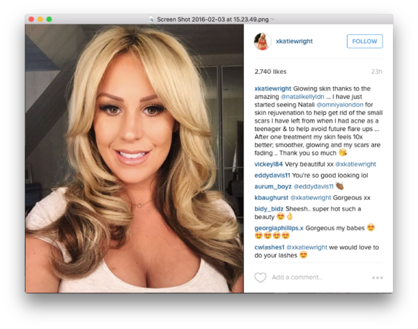Katie Wright Dermapen +PRP